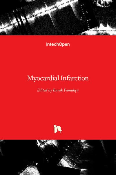 Cover for Burak Pamukcu · Myocardial Infarction (Hardcover Book) (2019)
