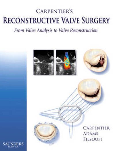 Cover for Carpentier, Alain (Professor &amp; Chairman, Department of Cardiothoracic Surgery, European Hospital of Georges Pompidou, Paris, France) · Carpentier's Reconstructive Valve Surgery (Hardcover Book) (2010)