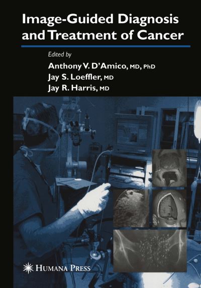 Cover for Image-Guided Diagnosis and Treatment of Cancer (Paperback Book) [Softcover reprint of the original 1st ed. 2003 edition] (2010)