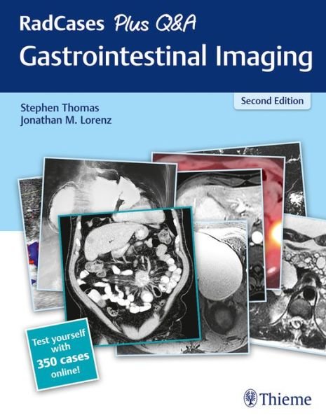 Cover for Stephen Thomas · RadCases Plus Q&amp;A Gastrointestinal Imaging - Radcases Plus Q&amp;A (Taschenbuch) (2020)