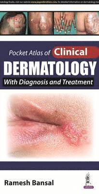 Cover for Ramesh Bansal · Pocket Atlas of Clinical Dermatology (Paperback Book) (2017)