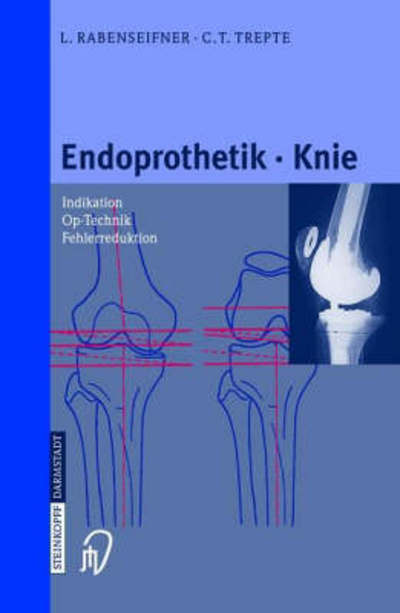 Cover for C. Trepte · Endoprothetik Knie (Hardcover Book) [German, 1 edition] (2001)