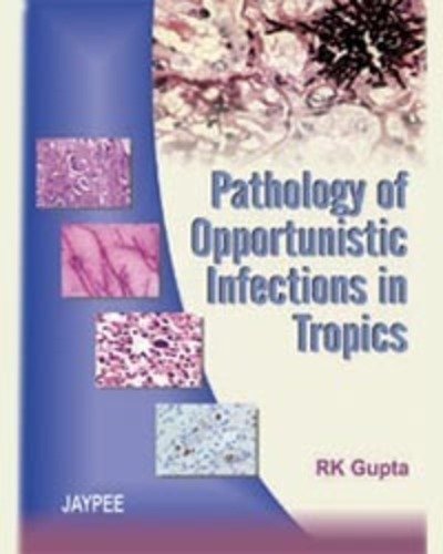 Cover for RK Gupta · Pathology of Opportunistic Infections in Tropics (Innbunden bok) (2007)
