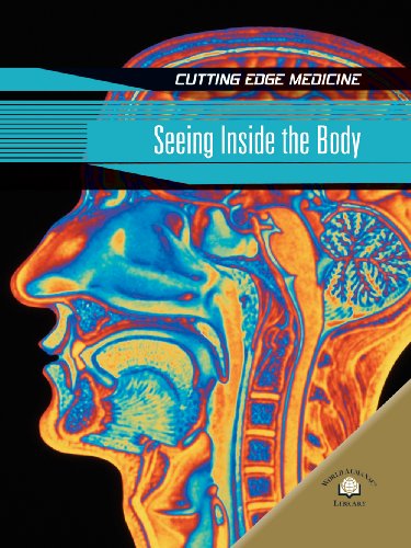 Cover for Andrew Solway · Seeing Inside the Body (Cutting Edge Medicine) (Hardcover Book) (2007)