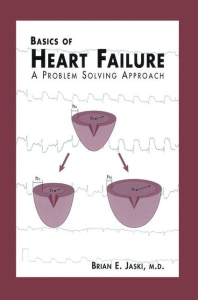 Basics of Heart Failure: A Problem Solving Approach - Developments in Cardiovascular Medicine - Brian E. Jaski - Books - Springer-Verlag New York Inc. - 9781461369691 - December 22, 2012
