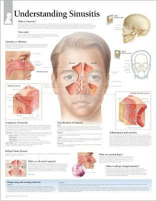 Understanding Sinusitis Laminated Poster - Scientific Publishing - Merchandise - Scientific Publishing - 9781932922691 - December 1, 2008