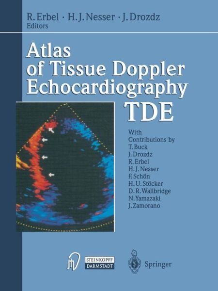 Atlas of Tissue Doppler Echocardiography - TDE - Raimund Erbel - Bøker - Steinkopff Darmstadt - 9783642470691 - 23. februar 2012