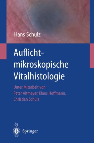 Cover for Hans Schulz · Auflichtmikroskopische Vitalhistologie: Dermatologischer Leitfaden (Paperback Book) [Softcover Reprint of the Original 1st 2002 edition] (2012)