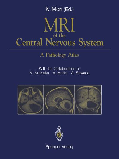 Cover for MRI of the Central Nervous System: A Pathology Atlas (Hardcover Book) (1991)