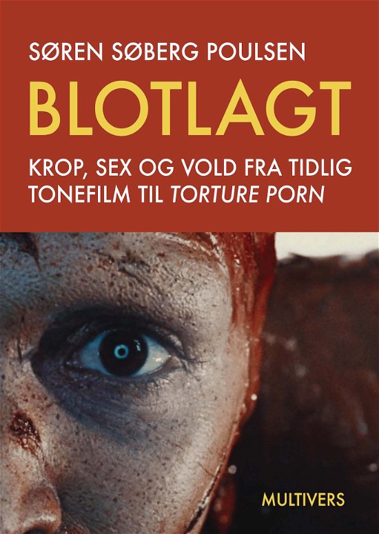 Cover for Søren Søberg Poulsen · Blotlagt (Sewn Spine Book) [1º edição] (2024)