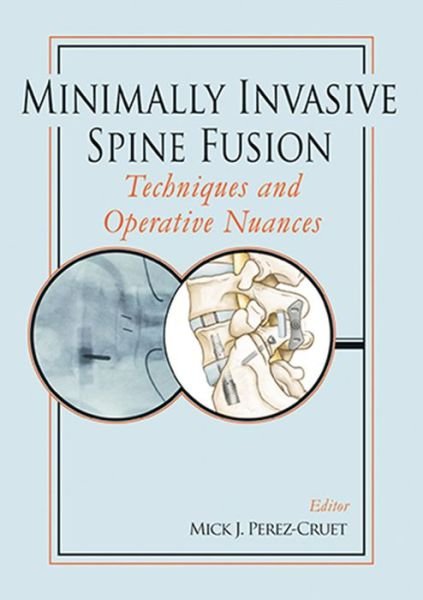 Cover for Cruet-Perez Mick · Minimally Invasive Spine Fusion: Techniques and Operative Nuances (Gebundenes Buch) (2011)