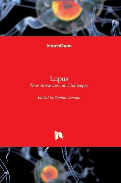 Cover for Sophia Lionaki · Lupus: New Advances and Challenges (Innbunden bok) (2020)