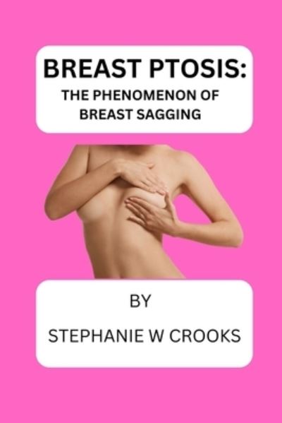 Cover for Crooks Stephanie W. Crooks · Breast Ptosis: The Phenomenon of Breast Sagging (Taschenbuch) (2022)