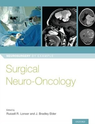 Cover for Surgical Neuro-Oncology - Neurosurgery by Example (Paperback Bog) (2018)