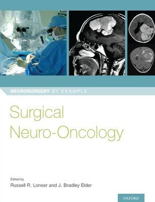 Cover for Surgical Neuro-Oncology - Neurosurgery by Example (Paperback Book) (2018)