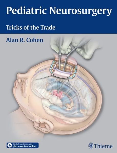 Pediatric Neurosurgery: Tricks of the Trade - Alan R. Cohen - Libros - Thieme Medical Publishers Inc - 9781604068696 - 18 de noviembre de 2015
