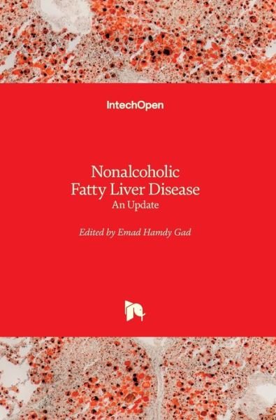 Cover for Emad Hamdy Gad · Nonalcoholic Fatty Liver Disease: An Update (Hardcover Book) (2019)