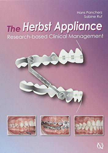 Cover for Sabine Ruf · The Herbst Appliance: Research-based Clinical Management (Hardcover Book) (2008)