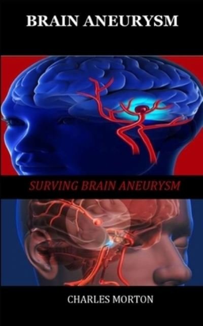 Cover for Charles Morton · Brain Aneurysm: Surviving Aneurysm (Paperback Bog) (2021)
