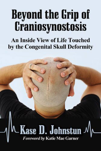 Cover for Kase D. Johnstun · Beyond the Grip of Craniosynostosis: An Inside View of Life Touched by the Congenital Skull Deformity (Pocketbok) (2015)