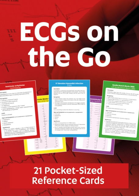 Cover for Steve Poulton · ECGs On The Go (Lernkarteikarten) (2024)