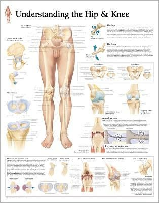 Understanding the Hip & Knee Laminated Poster - Scientific Publishing - Merchandise - Scientific Publishing Limited - 9781930633698 - 1. august 2004