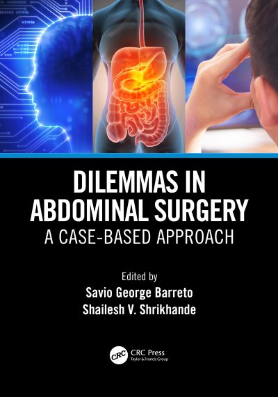 Cover for Savio George Barreto · Dilemmas in Abdominal Surgery: A Case-Based Approach (Paperback Book) (2020)