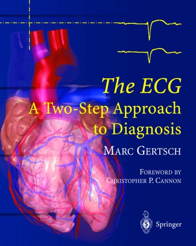 Cover for Marc Gertsch · The ECG: A Two-Step Approach to Diagnosis (Hardcover Book) [2004 edition] (2003)
