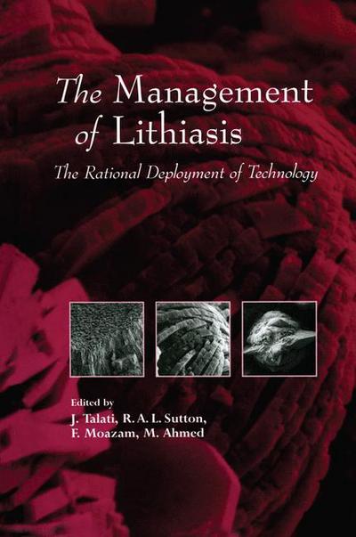 Jamsheer J Talati · The Management of Lithiasis: The Rational Deployment of Technology - Developments in Nephrology (Taschenbuch) [Softcover reprint of the original 1st ed. 1997 edition] (2012)