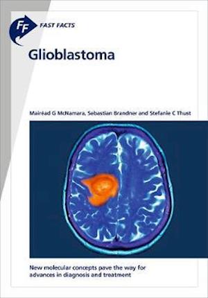 Cover for McNamara · Fast Facts: Glioblastoma (Book) (1920)