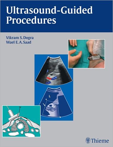 Ultrasound-Guided Procedures - Vikram S. Dogra - Bøger - Thieme Medical Publishers Inc - 9781604061703 - 26. oktober 2009