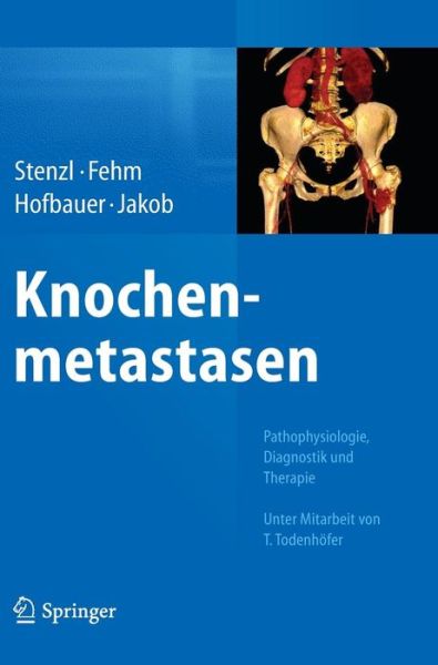 Cover for Arnulf Stenzl · Knochenmetastasen: Pathophysiologie, Diagnostik Und Therapie - Unter Mitarbeit Von T. Todenhoefer (Hardcover Book) [2014 edition] (2014)