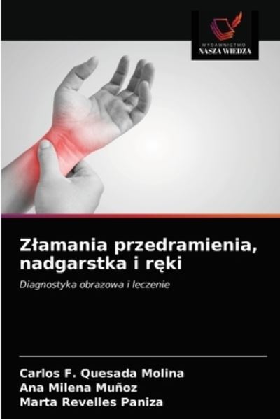Cover for Carlos F Quesada Molina · Zlamania przedramienia, nadgarstka i r?ki (Paperback Book) (2021)
