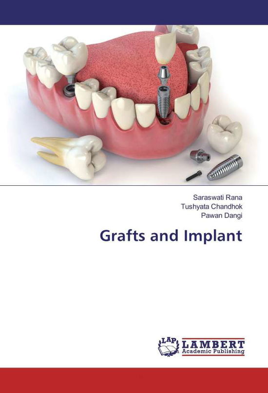 Cover for Rana · Grafts and Implant (Book)