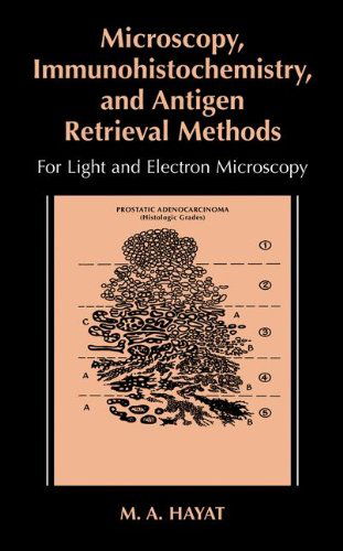 Microscopy, Immunohistochemistry, and Antigen Retrieval Methods: For Light and Electron Microscopy - M.A. Hayat - Livros - Springer Science+Business Media - 9780306467707 - 30 de junho de 2002