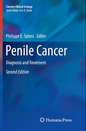 Cover for Penile Cancer: Diagnosis and Treatment - Current Clinical Urology (Paperback Book) [Softcover reprint of the original 2nd ed. 2017 edition] (2018)
