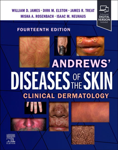 Cover for James, William D., MD (Emeritus Professor of Dermatology, Department of Dermatology, Perelman School of Medicine, University of Pennsylvania, Philadelphia, Pennsylvania, USA) · Andrews' Diseases of the Skin: Clinical Dermatology (Hardcover Book) (2024)