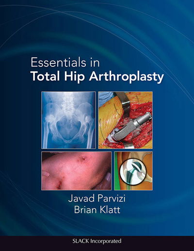 Cover for Javad Parvizi · Essentials in Total Hip Arthroplasty (Hardcover Book) (2013)