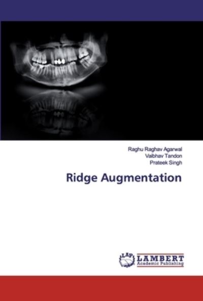 Cover for Agarwal · Ridge Augmentation (Bog) (2020)