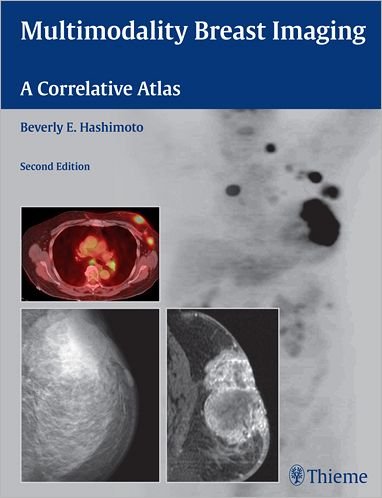 Multimodality Breast Imaging: A Correlative Atlas - Beverly Hashimoto - Libros - Thieme Medical Publishers Inc - 9781604061710 - 21 de mayo de 2010