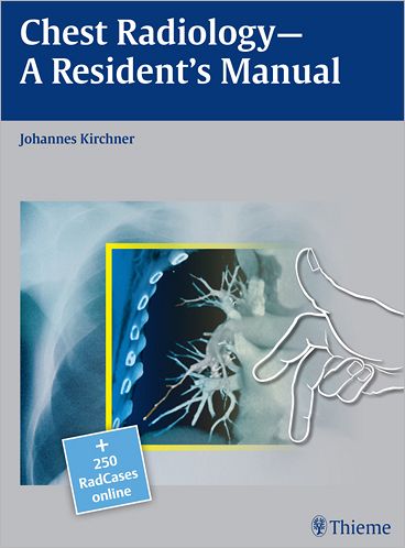 Cover for Johannes Kirchner · Chest Radiology: A Resident's Manual (Gebundenes Buch) (2011)