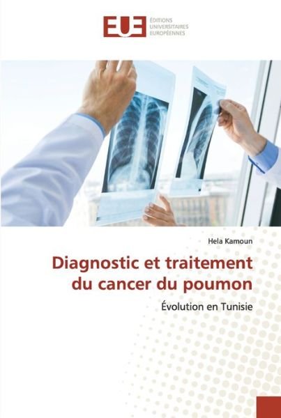 Cover for Hela Kamoun · Diagnostic et traitement du cancer du poumon (Paperback Book) (2021)