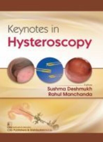 Cover for Sushma Deshmukh · Keynotes in Hysteroscopy (Paperback Book) (2019)