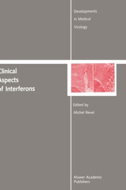 Cover for Michel Revel · Clinical Aspects of Interferons - Developments in Medical Virology (Hardcover Book) [1988 edition] (1988)