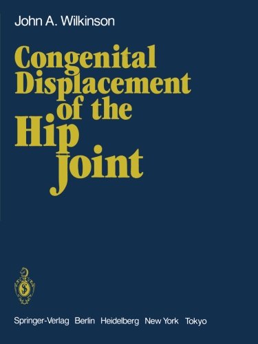 J.A. Wilkinson · Congenital Displacement of the Hip Joint (Pocketbok) [Softcover reprint of the original 1st ed. 1985 edition] (2011)