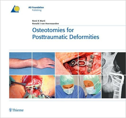 Cover for Rene K. Marti · Osteotomies for Posttraumatic Deformities - AO-Publishing (Hardcover Book) (2008)