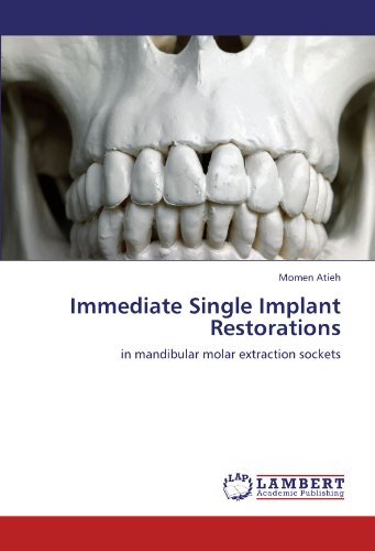 Cover for Momen Atieh · Immediate Single Implant Restorations: in Mandibular Molar Extraction Sockets (Paperback Bog) (2012)