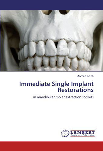 Immediate Single Implant Restorations: in Mandibular Molar Extraction Sockets - Momen Atieh - Books - LAP LAMBERT Academic Publishing - 9783847372714 - January 20, 2012