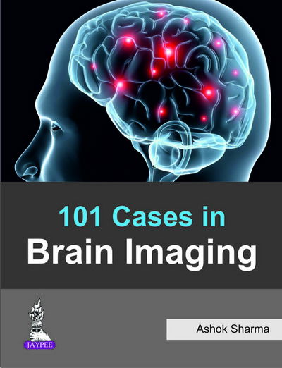 101 Cases in Brain Imaging - Ashok Sharma - Livros - Jaypee Brothers Medical Publishers - 9789351525714 - 20 de janeiro de 2015