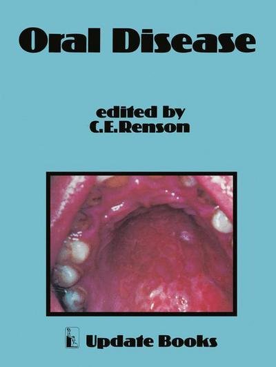 C E Renson · Oral Disease (Paperback Book) [Softcover reprint of the original 1st ed. 1978 edition] (2011)